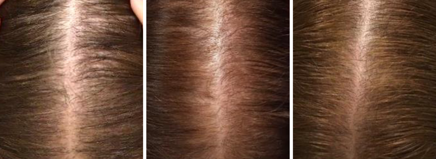 MDhair